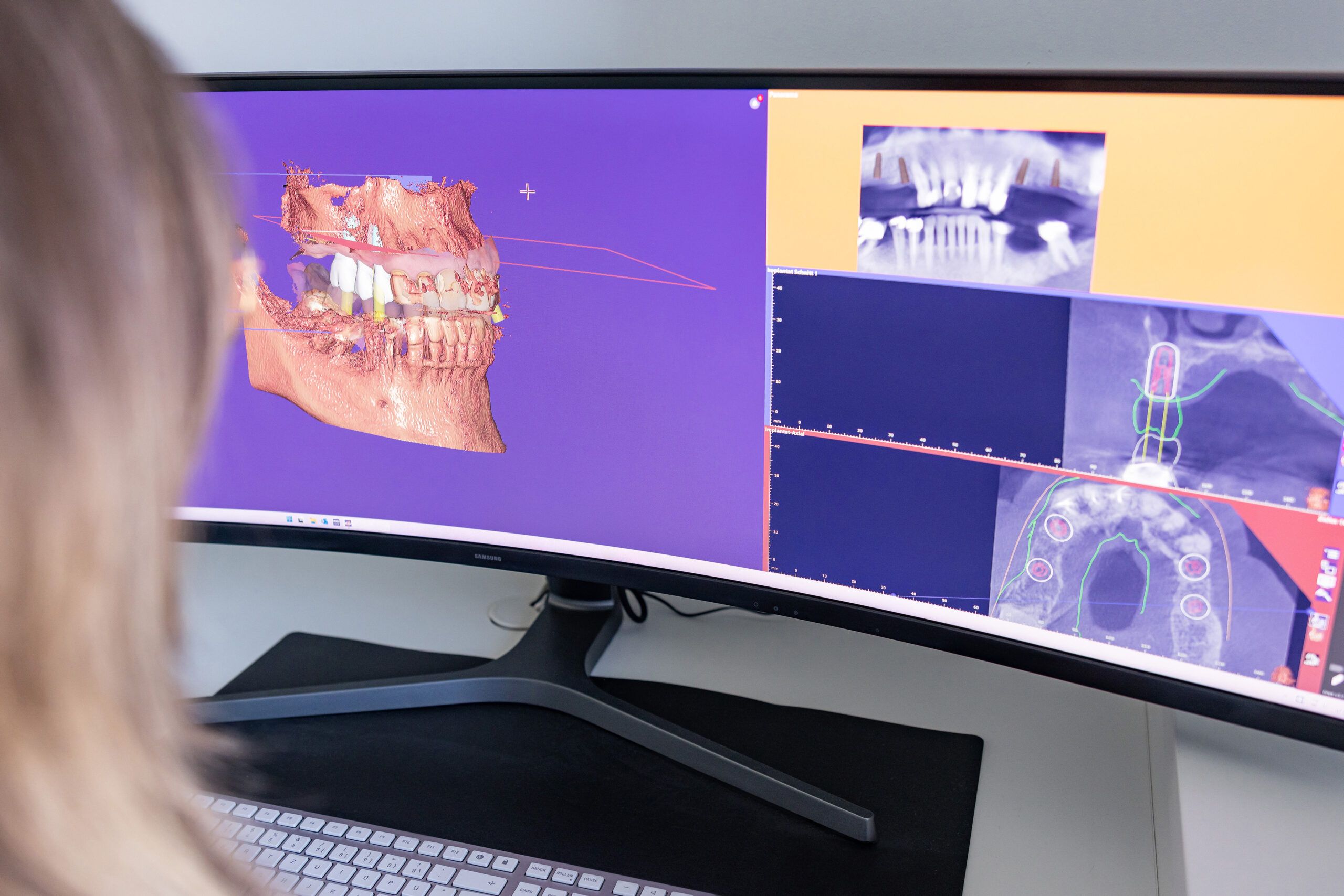 3D-Planung für Zahnersatz bei Zahnärzte K1 Schärding